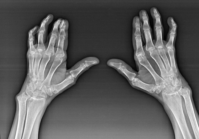Hatzaren artikulazioen diagnostikoak